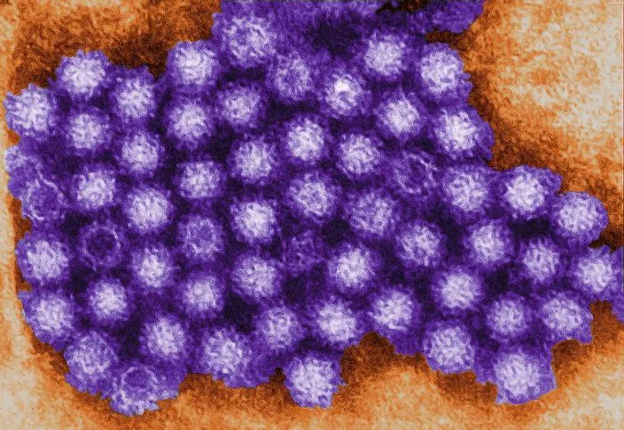 Norovirus: Symptoms, Transmission, Prevention, and Treatment Explained