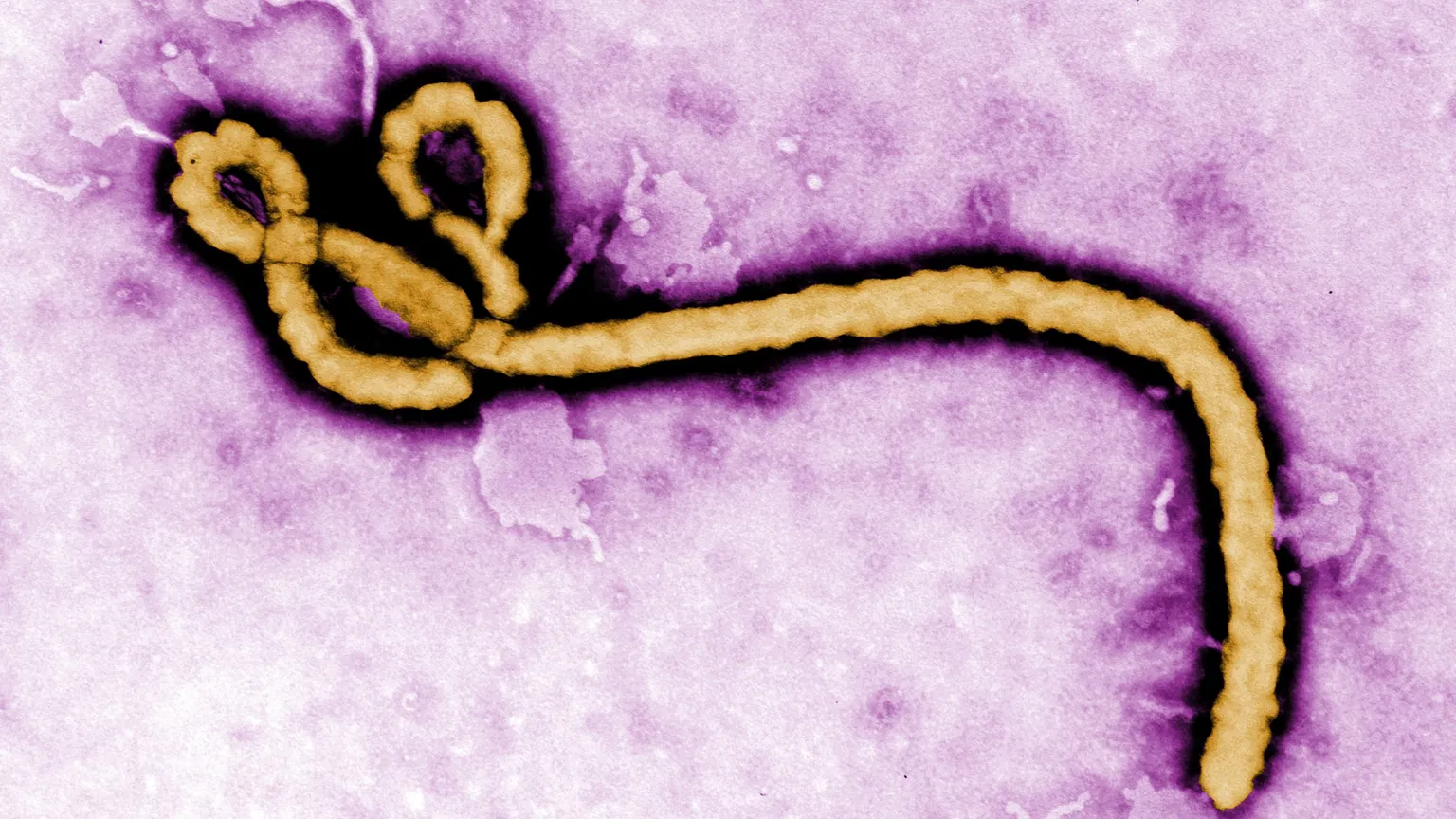 Understanding Ebola: What It Is, How It Spreads, and What You Need to Know
