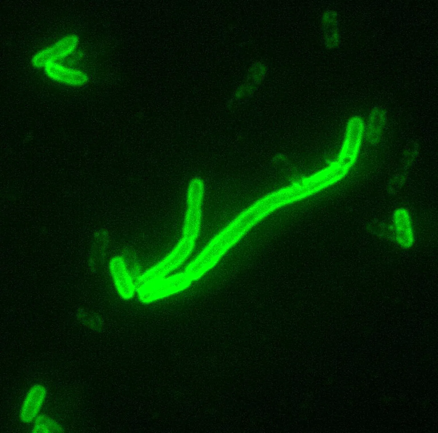 What Is Pneumonic Plague? Symptoms, Spread, and Treatment