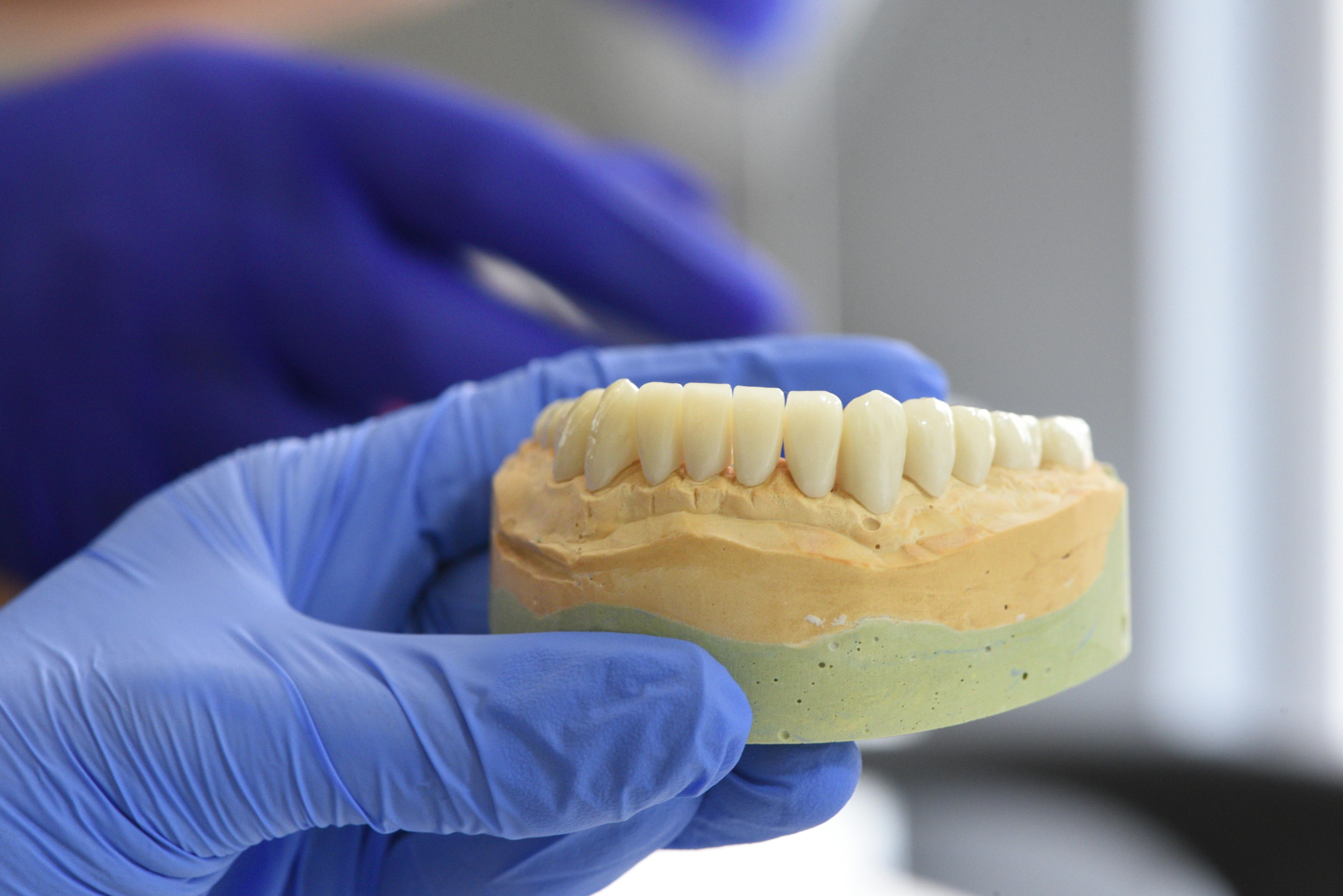 what are dental implants made of_d06c2fad 118a 46b0 869e 9beb013fa732
