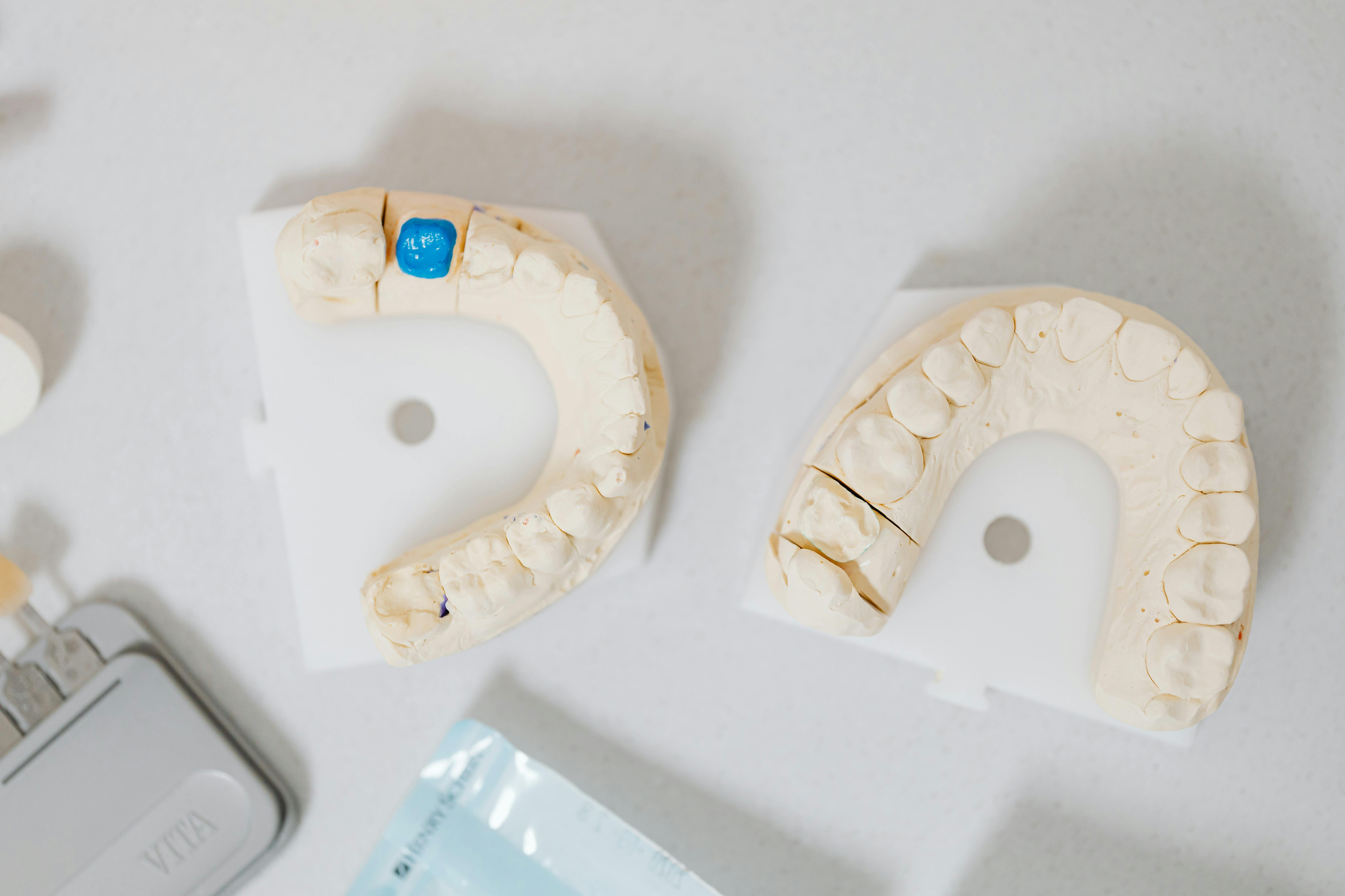 what are dental implants made of_d73bd095 7b29 4dc6 ace5 bb3dcf0af8de